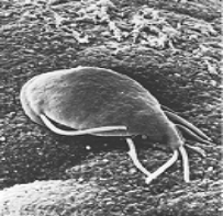   -To which of the following groups does the organism in the above figure belong? A)  diplomonads, parabasalids, trypanosomes, and euglenoids B)  ciliates, dinoflagellates, and apicomplexans C)  water molds, diatoms, and brown algae D)  chlorophyte and charophyte algae E)  amoebas and slime molds