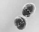   -The above organism is responsible for fish kills and belongs to which of the following groups? A)  chrysophytes B)  dinoflagellates C)  flagellated protozoans D)  ciliates E)  oomycotes