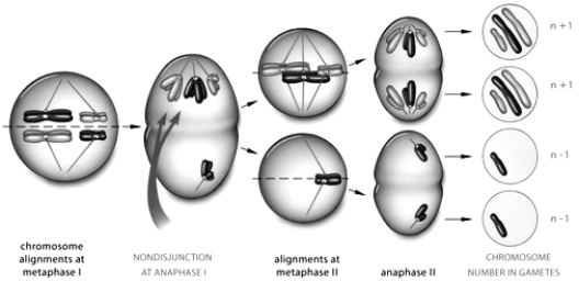   -The above figure represents which of the following: A)  a male with trisomy 21 B)  a female with trisomy 21 C)  a result caused by the use of colchicine D)  a gorilla globin gene spread E)  none of these