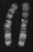 -The above figure represents A) individual genes from an asexual worm. B) maternal chromosomes that are identical. C) paternal chromosomes that are identical. D) both maternal and paternal chromosomes. E) none of these.