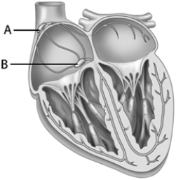 <strong>In this diagram of the heart, A is the ____ and B is the ____. </strong> A) AV node; cardiac pacemaker B) SA node; septum C) AV node; SA node D) SA node; AV node E) septum; cardiac pacemaker