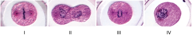 Examine the micrographs below to answer the following question.   The cell in micrograph  II  is at which stage of the cell cycle? A)  prophase B)  telophase C)  interphase D)  anaphase E)  metaphase 