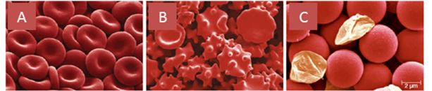 In the following pictures of red blood cells emerged in three different solutions, identify which picture corresponds to each of the following solutions.   a. A b. B c. C -hypotonic