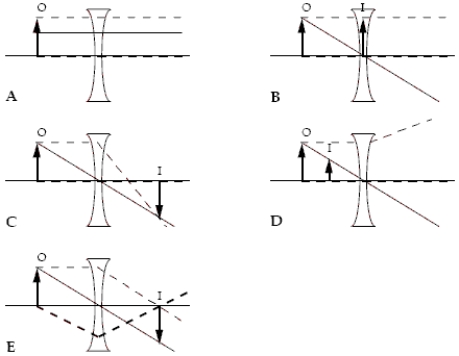Which ray diagram is correct? The three rays in each diagram are distinguished by different types of lines.Hint: Check the behaviour of each ray as it interacts with the lens.   A) A B) B C) C D) D E) E