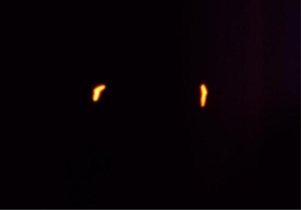 A microbiologist performs a Gram stain on a positive blood culture bottle. She does not observe any organisms. She then uses an acridine orange stain and observes the organisms pictured in the image. What type of microscope did she use to observe the rod-like organisms?   A)  Brightfield B)  Darkfield C)  Phase contrast D)  Fluorescent