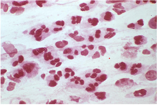Review the Gram stain image of a cerebrospinal fluid. Based on the results, you should   A)  look at a drop of the specimen under a darkfield microscope. B)  prepare a new slide and perform a Kinyoun stain. C)  prepare a new slide and perform an acridine orange stain. D)  report the slide as  no organisms seen. 