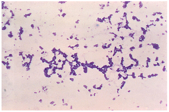 Review the Gram stain image provided of a positive blood culture bottle. It should be   A)  pleomorphic gram-positive coccobacilli. B)  gram-positive cocci in pairs and chains. C)  gram-positive cocci in clusters. D)  palisading gram-negative cocci.