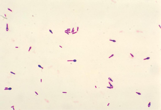 Review the image of a leg wound culture provided. The organisms appear as gram-variable rods. What Gram stain reaction should be reported for this organism?   Source: CDC and Dr. George Lombard A)  Gram negative B)  Gram positive C)  Gram variable D)  Gram positive and gram negative