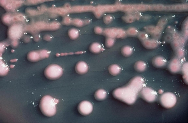 Based on the colonies observed in the image provided, you can deduce the organism   1)  is a gram-negative rod. 2)  is a gram-positive coccus. 3)  produces a capsule. 4)  produces a pigment. A)  1, 3, and 4 B)  2, 3, and 4 C)  2 and 4 D)  1 and 3