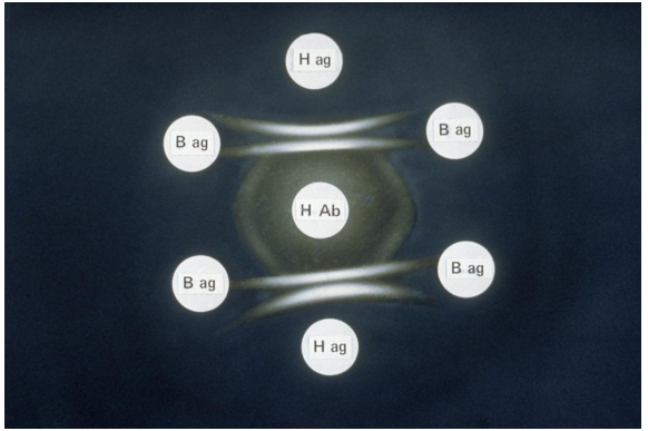 The image provided is an example of a/an _________________ test.   A)  agglutination B)  precipitation C)  complement fixation D)  immunoelectrophoresis