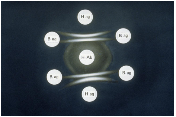 Using the image provided, interpret the results depicted.   Key to image: H Ab = Histoplasma capsulatum antibodies, H Ag = extract of Histoplasma capsulatum, B Ag = extract of Blastomyces dermatitidis A)  The B. dermatitidis extract shows the presence of an antigen that cross reacts with the antibodies present. B)  The antigens present in the B)  dermatitidis and H. capsulatum extracts are partially cross reactive. C)  The H. capsulatum extract shows a non-identity reaction with the antibodies D)  The H. capsulatum extract shows the presence of two antigens that cross react with the antibodies present.