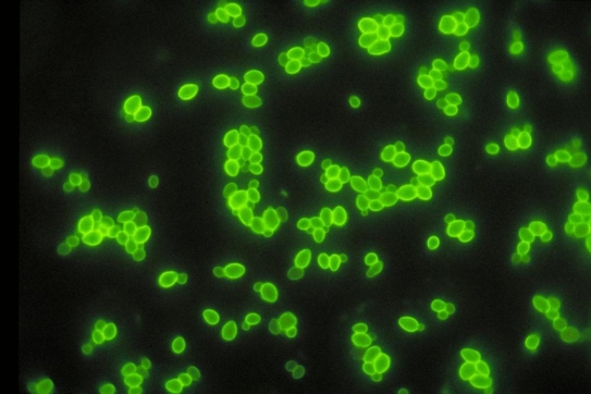 Review the image provided and interpret the direct fluorescent antibody reaction observed.   Source: CDC, Maxine Jalbert, Dr. Leo Kaufman A)  Positive for yeast B)  Negative for yeast C)  Positive for gram-positive cocci D)  Negative for gram-positive cocci