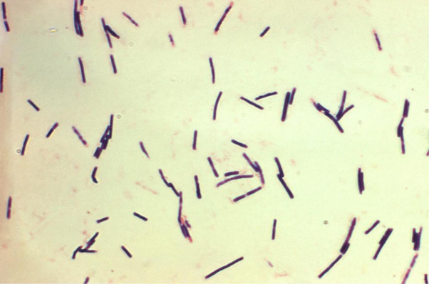 Review the image provided. The presence of this organism in a tissue sample suggests   Source: CDC and Don Stalons A)  Corynebacterium spp. B)  yeast. C)  Clostridium spp. D)  Erysipelothrix rhusiopathiae.