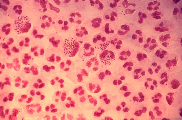<strong>A 17-year-old male develops septic arthritis in his left knee. His physician aspirates synovial fluid and sends it to the microbiology laboratory. A direct Gram stain of the fluid is demonstrated in the image provided.   Source: CDC/Joe Millar Which of the following tests is necessary for definitive identification of this Organism?</strong> A) coagulase test. B) streptococcal serotyping. C) rapid carbohydrate fermentation test. D) spot indole test. <div style=padding-top: 35px> 