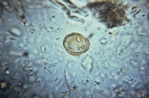 Review the image provided and identify it.   Source: CDC A)  Pollen granule B)  Taenia spp. ova C)  Plant cell D)  Yeast cell