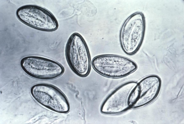 Review the image provided.   Source: CDC What laboratory procedure was used to recover this organism? A)  Vaspar swab prep of perianal region B)  Wet prep of concentrated stool C)  Trichrome stain of stool smear D)  Wet prep of duodenal aspirate