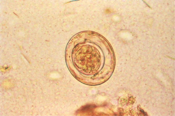 Review the image provided.   Source: CDC In the life cycle of this organism, man serves as the ________________ host. A)  intermediate B)  definitive C)  vector D)  reservoir