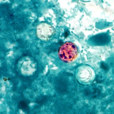  A 20-year-old male with leukemia presents with watery diarrhea of two weeks duration, nausea, weight loss, and anorexia. A stool sample is submitted for routine culture and ova and parasite examination. The routine culture is negative for Salmonella, Shigella, Campylobacter, Yersinia enterocolitica, and shiga-toxin producing E. coli. The concentrated wet mount exam and trichrome stained stool smear are negative. Additional testing revealed the organism as seen in the image provided.   Source: CDC/DPDx - Melanie Moser Knowing the organism measures 9  \mu  m, you would identify it as A)  Cryptosporidium parvum. B)  Cyclospora cayetanensis. C)  microsporidia. D)  yeast. 
