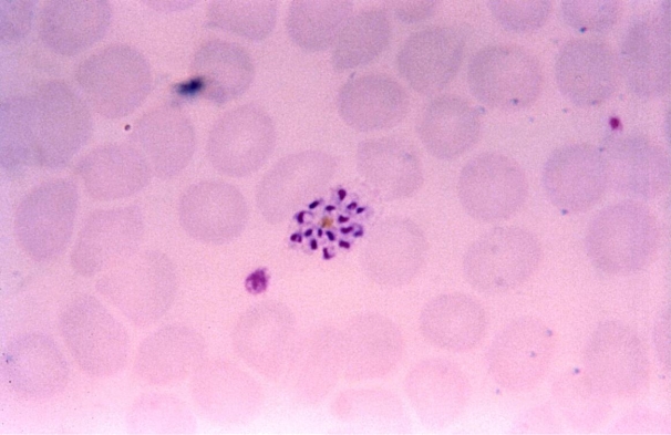 A 47-year-old male, who lives in Bangor, ME, returns from a trip to Southeast Asia. He visits his physician with fever, chills, headache, and malaise. His fevers seem to appear every 48 hours. A blood smear reveals the organism as seen on the image provided.   Source: CDC/Steven Glenn, Laboratory Training & Consultation Division Given this information, you would report the organism as A)  Plasmodium vivax. B)  P. ovale. C)  P. malariae. D)  Babesia microti.