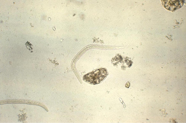Prior to his kidney transplant, a 56-year-old male is tested for ova and parasites. One of three stools submitted demonstrates the organisms seen in the image provided.   Source: CDC/Dr. Mae Melvin You would identify the organisms as A)  Hookworm spp. filariform larvae. B)  Strongyloides stercoralis filariform larvae. C)  Hookworm spp. rhabditiform larvae. D)  Strongyloides stercoralis rhabditiform larvae.