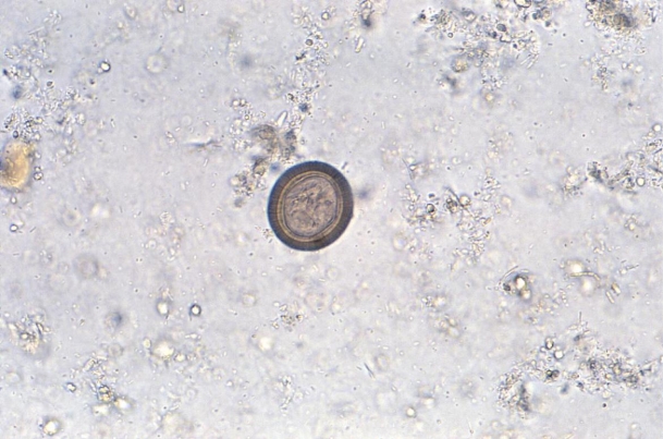 A 30-year-old male, who is a recent immigrant from Mexico, presents to a clinic saying he has long strands of what looks like cooked macaroni in his stool. A stool sample reveals the organism seen in the image provided.   Source: CDC/Dr. Mae Melvin This individual is harboring A)  Taenia solium. B)  Taenia saginata. C)  A parasite that requires review of a proglottid. D)  A parasite that requires review of the scolex.