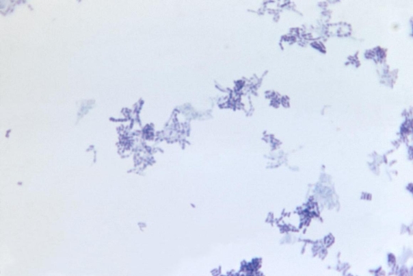 <strong>A 78-year-old male develops osteomyelitis after hip replacement surgery. After four weeks of antibiotics, he is sent home with two more weeks of intravenous antibiotics. On week 5, he develops a fever, and three sets of blood cultures are drawn. At 24 hours, the organism observed in the image provided was present in four of six bottles.   Source: CDC and Dr. W. Kaplan The organism grows as a pinpoint haze on sheep blood and chocolate agars but not on MacConkey and reducible blood agars. Infection with this organism was probably due to</strong> A) antibiotic use. B) the presence of an artificial hip. C) a urinary catheter. D) the presence of an IV catheter. <div style=padding-top: 35px> 