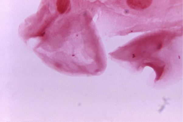 Review the image provided. The presence of this cell in an expectorated sputum indicates   Source: CDC and James Volk A)  an unacceptable specimen unless accompanied by the presence of white blood cells. B)  an acceptable specimen if <10 per low power field are present. C)  an acceptable specimen if <25 per high power field are present. D)  an unacceptable specimen for Legionella spp. culture.
