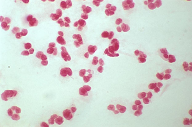 A pleural fluid is received in a capped syringe. A portion is centrifuged and the sediment is used to plate to sheep blood, chocolate, and MacConkey agars as well as a thioglycolate broth. The direct Gram stain results are demonstrated in the image  provided   Source: CDC and Dr. Norman Jacobs At 24 hours, 2 colonies of a white, gamma-hemolytic colony were present on the sheep Blood agar. The organism is a catalase-positive, Staphylococcus latex Agglutination- negative, gram-positive coccus. The organism proved to be oxacillin Resistant on susceptibility testing. Based on these results, you A)  report very light growth Staphylococcus aureus. B)  report very light growth Staphylococcus not S. aureus. C)  complete a variance report because a reducible blood agar should have been added initially. D)  a and c. E)  b and c.