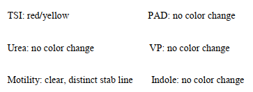 An oxidase negative, non-lactose fermenter isolated from the stool culture of a 3-year-old female with bloody diarrhea. The organism proves to be:   If it serotypes as a group D, you would identify the organism as A)  Salmonella typhi. B)  Shigella dysenteriae. C)  Shigella sonnei. D)  The serotype must be repeated after boiling the organism suspension.