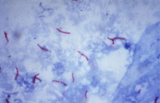 A sputum, submitted for AFB culture and smear, demonstrates the Kinyoun stain provided.   Source: CDC and Dr. George P. Kubica The organism isolated on Lowenstein-Jensen agar provided the following reactions: Pigment: buff-colored colonies in the dark and yellow when exposed to light   This organism is A)  Mycobacterium gordonae. B)  M. marium. C)  M. kansasii. D)  M. bovis.