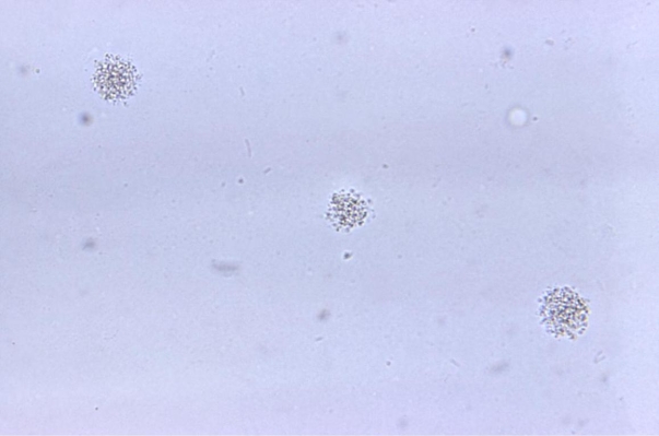 Given the colony on A-8 agar provided in the image, what was the original source of the specimen cultured?   Source: CDC and Dr. Francis Forrester A)  Sputum B)  Blood C)  Urine D)  Amniotic fluid