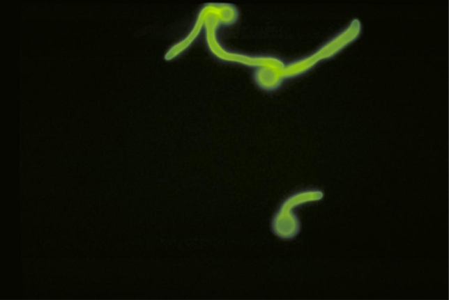What fungal structure is demonstrated in the image provided?   Source: CDC/Mercy Hospital, Toledo, OH; Dr. Brian Harrington A)  Blastoconidia B)  Pseudohyphae C)  Germ tube D)  True hyphae