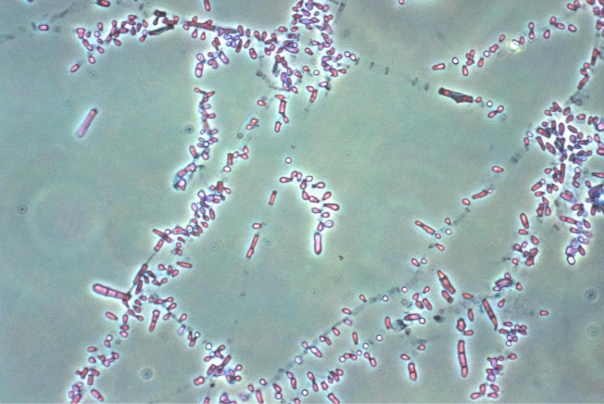 A 17-year-old high school football player presents with burning, itching, and peeling skin between his toes. He visits his physician because home treatment is not working. The physician suspects one of three possible dermatophytes is the cause of the infection. The image provided is the microscopic examination of the colony that eventually grew on DTM medium.   Source: CDC and Dr. Libero Ajello This organism will be A)  urea positive. B)  positive for in-vitro hair perforation. C)  an olive or khaki colony. D)  able to produce a red pigment on CMA.