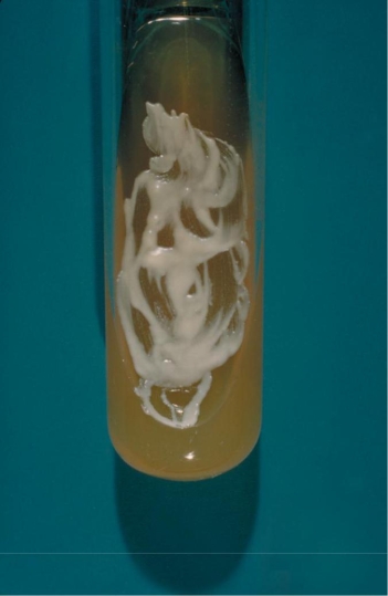 Prior to returning to college for the fall, a 20-year-old male presents with numerous nodules and ulcers on this fingers. His history is significant because he worked for the summer on a farm bailing hay. The physician swabs the ulcers and sends the specimen to the microbiology department for routine and fungal culture. The routine culture showed no growth at 48 hours. Growth on the fungal agars incubated at 35°C and room temperature appear in the images provided.   35°C incubation Source: CDC and Dr. Lucille K. Georg   25°C incubation Source: CDC and Dr. William Kaplan On microscopic examination of the 35 degree isolate, you would expect to see. A)  Broad based budding yeast B)  Arthrospores C)  Yeast resembling cigar bodies D)  Spherules