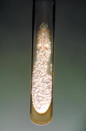 Prior to returning to college for the fall, a 20-year-old male presents with numerous nodules and ulcers on this fingers. His history is significant because he worked for the summer on a farm bailing hay. The physician swabs the ulcers and sends the specimen to the microbiology department for routine and fungal culture. The routine culture showed no growth at 48 hours. Growth on the fungal agars incubated at 35°C and room temperature appear in the images provided.   35°C incubation Source: CDC and Dr. Lucille K. Georg   25°C incubation Source: CDC and Dr. William Kaplan On microscopic examination of the 35 degree isolate, you would expect to see. A)  Broad based budding yeast B)  Arthrospores C)  Yeast resembling cigar bodies D)  Spherules