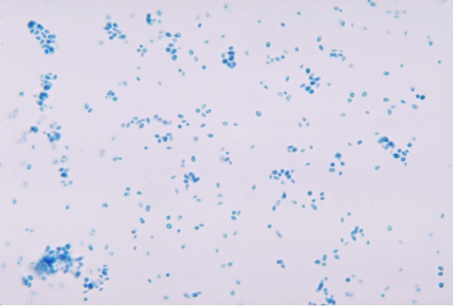A urine culture grows >100,000 colonies/mL of a pinpoint gray colony. Gram stain of the colony reveals blastoconidia. A RIOT agar is set up and read at 24 and 48 hours.    Source: CDC and Dr. Leanor Haley What is the presumptive identification of this organism? A)  Candida dubliniensis B)  C. glabrata C)  C)  albicans D)  C. tropicalis