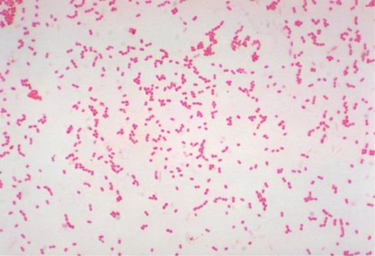 A patient in the intensive care unit has developed pneumonia. A sputum culture grows an oxidase-negative, non-lactose fermenter. The organism is demonstrated in the Gram stain below. The microbiologist works up the organism as a member of the Enterobacteriaceae. The next day she realizes her error. The organism displays the following results:   Source: CDC and Dr. W. A. Clark TSI: K/NC Motility: negative OF medium: Open tubes: glucose: yellow, lactose: yellow, maltose: green Closed tubes: glucose: green, lactose: green, maltose: green A)  Stenotrophomonas maltophilia. B)  Acinetobacter baumannii. C)  Moraxella lacunata. D)  Pseudomonas fluorescens.