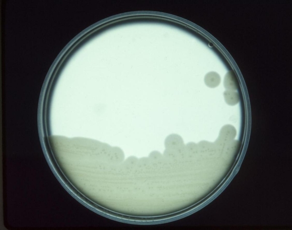 An anaerobic, spore-forming, gram-positive rod is subbed to an egg yolk agar. Given the result provided on the EYA image provided, what organism do you suspect?   Source: CDC A)  Bifidobacterium spp. B)  Lactobacillus spp. C)  Clostridium septicum D)  C. perfringens