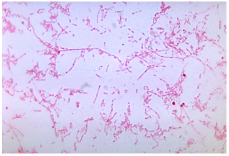 A 17-year-old male presents with a deep and extensive tonsillar abscess. He shares with the physician that he has recently had a sore throat. A direct Gram stain reveals the image provided here.   Source: CDC and Dr. V. R. Dowell, Jr. The anaerobic organism provides the following reactions:   What additional test is needed to correctly identify this organism? A)  Esculin B)  Pigmentation C)  Lecithinase D)  Lipase