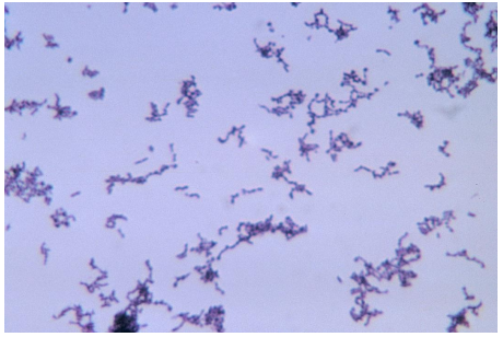 A 59-year-old female, with fever of unknown origin, has three sets of blood culture bottles drawn within a 24-hour period. At 24 hours incubation, one anaerobic blood Culture bottle reveals the organism seen in the Gram stained image provided.   Source: CDC and Bobby Strong The small, white, anaerobic colony that grows proves to be catalase, indole-positive, and resistant to SPS. This organism can be 1)  presumptively identified as Propionibacterium acnes. 2)  presumptively identified as Peptostreptococcus anaerobius. 3)  considered a probable contaminant in this case. 4)  considered clinically significant in this case A)  1 and 3 B)  1 and 4 C)  2 and 3 D)  2 and 4