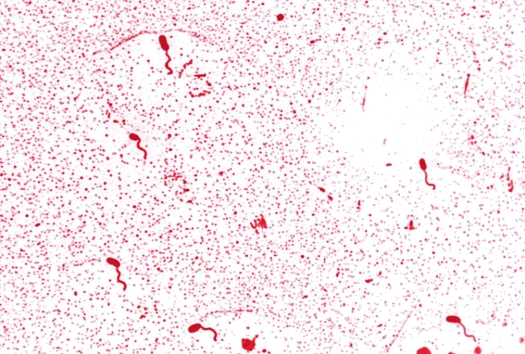The flagellar arrangement of Vibrio cholerae, as seen in the image provided, can be described as   Source: CDC and Dr. William A. Clark A)  monotrichous. B)  amphitrichous. C)  lophotrichous. D)  peritrichous.
