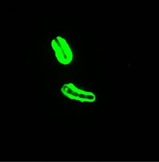 The presence of the structure on this rod-shaped organism, as noted in the image provided, allows it to do all of the following except   Source: CDC and Larry Stauffer, Oregon State Public Health Laboratory A)  demonstrate purposeful movement. B)  avoid phagocytes. C)  deter antibodies and complement. D)  enhance its virulence.