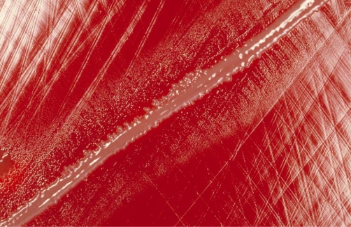 <strong>A positive blood culture displays gram-positive cocci in chains. A sample is plated to blood, chocolate, and MacConkey agars. After 24 hours incubation in CO<sub>2</sub> (BA, CA) and ambient air (MAC), all agar plates show no growth. An additional test was performed and the results are provided in the image provided. Based on these results, the organism is suspicious for   Source: CDC and Dr. Mike Miller</strong> A) viridians Streptococcus. B) nutritionally variant Streptococcus. C) Aerococcus spp. D) Gemella spp. <div style=padding-top: 35px> 