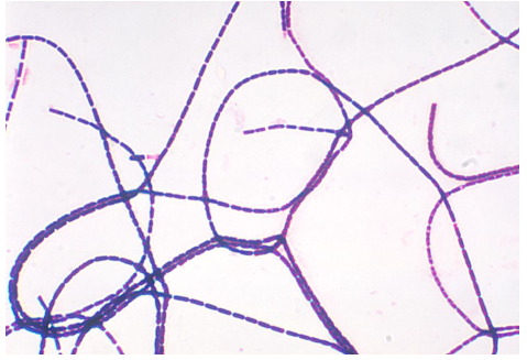 <strong>A blood culture reveals the Gram stain results observed in the image provided.   The microbiologist should</strong> A) ignore this organism as a contaminant. B) call the physician and report it as presumptive Bacillus anthracis. C) suspect Clostridium spp. and plate to anaerobic media. D) follow the CDC recommendations for the workup of a potential Bacillus anthracis. <div style=padding-top: 35px> 