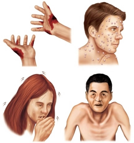 The four types of biological weapons, pictured here, are   A)  toxins, poisons, microbes, and viruses. B)  fevers, rickettsia, prions, and bacteria. C)  bacteria, viruses, rickettsia, and toxins. D)  prions, fevers, microbes, and poisons.