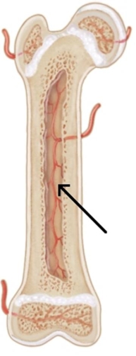 In the picture below, the arrow is pointing to which of the following?   A)  Compact bone B)  Epiphyseal plate C)  Growth plate D)  Medullary cavity