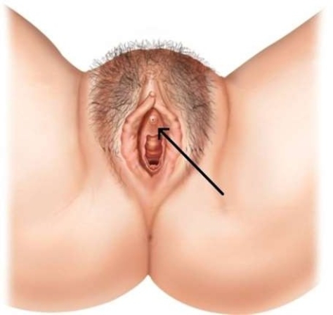 In this picture, the arrow is pointing to the   A)  vestibule. B)  urethal opening. C)  clitoris. D)  labia minora.