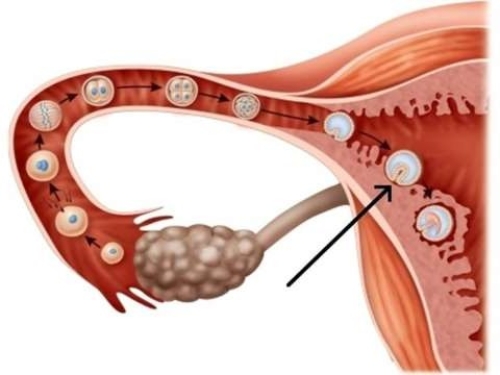 In the picture, which day is the arrow pointing to when the egg implants in the wall of the uterus?	   A)  Day 9 B)  Day 3 C)  Day 5 D)  Day 7