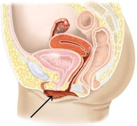 <strong>In the picture below, the arrow is pointing to the  </strong> A) labia minora B) symphysis pubis. C) labia majora. D) clitoris. <div style=padding-top: 35px> 