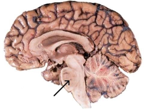 <strong>The portion of the brain, referred to in this image, which has an influence on respiration is the  </strong> A) midbrain. B) medulla oblongata. C) pons. D) corpus callosum. <div style=padding-top: 35px> 